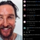 "BEE SWELL," MATTHEW MCCONAUGHEY SHARES PHOTO OF SWOLLEN EYE AFTER A BEE STING