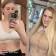 MEGHAN TRAINOR UNVEILS BEFORE AND AFTER BOOB JOB