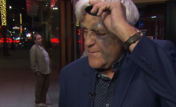 JAY LENO SURVIVES ANOTHER SERIOUS ACCIDENT, PERFORMS DESPITE INJURIES