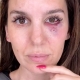 CHRISTY CARLSON ROMANO SURVIVES TERRIFYING SHOOTING ACCIDENT: 'I SAW MY LIFE FLASH BEFORE MY EYES'