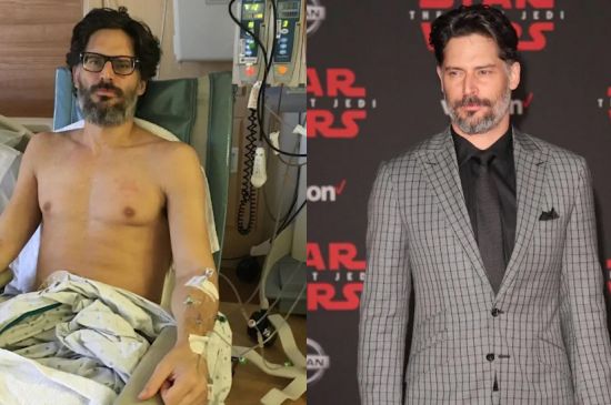 JOE MANGANIELLO REVEALS DEVASTATING HEALTH BATTLE PHOTOS