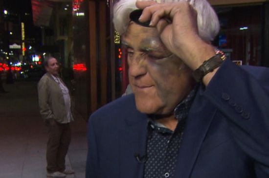 JAY LENO SURVIVES ANOTHER SERIOUS ACCIDENT, PERFORMS DESPITE INJURIES