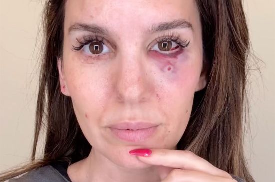 CHRISTY CARLSON ROMANO SURVIVES TERRIFYING SHOOTING ACCIDENT: 'I SAW MY LIFE FLASH BEFORE MY EYES'